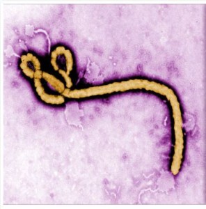 EbolaVirusImage
